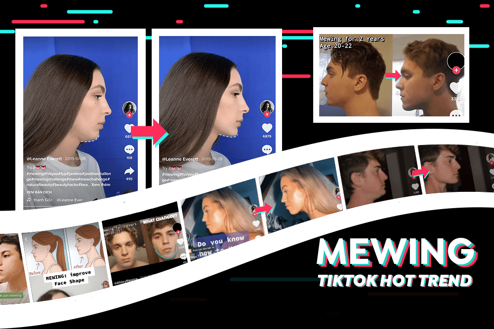 Nọng cằm biến mất trong 1 giây với Mewing - “cơn sốt” mới trên Tiktok