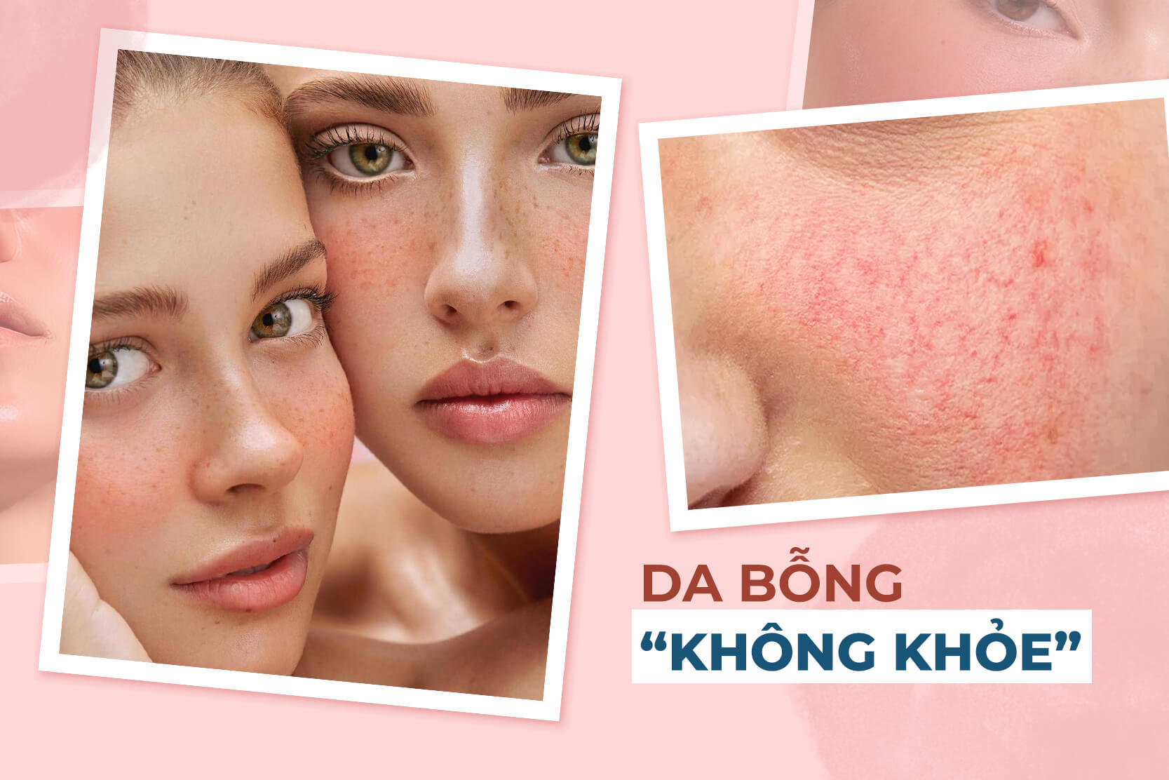 Da khoẻ bỗng khô rát, ửng đỏ, nguyên nhân bắt nguồn từ thói quen ai cũng cho là tốt