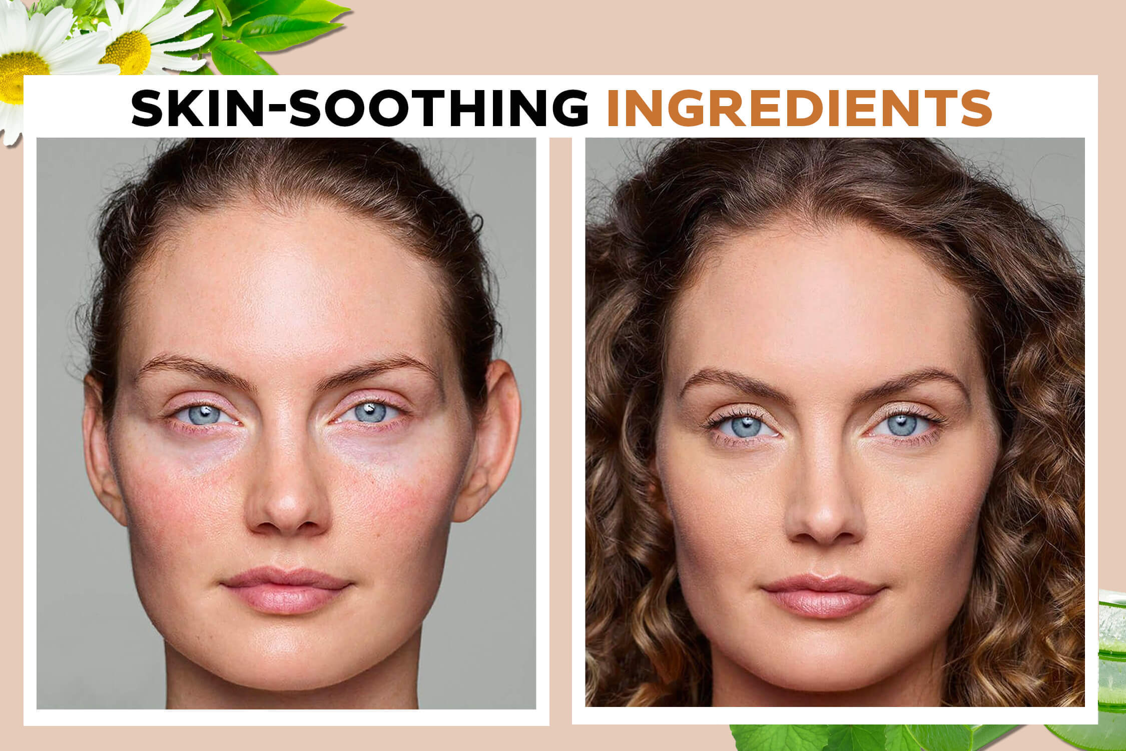 5 thành phần làm dịu da tức thì, team da nhạy cảm nên thêm ngay vào skincare routine