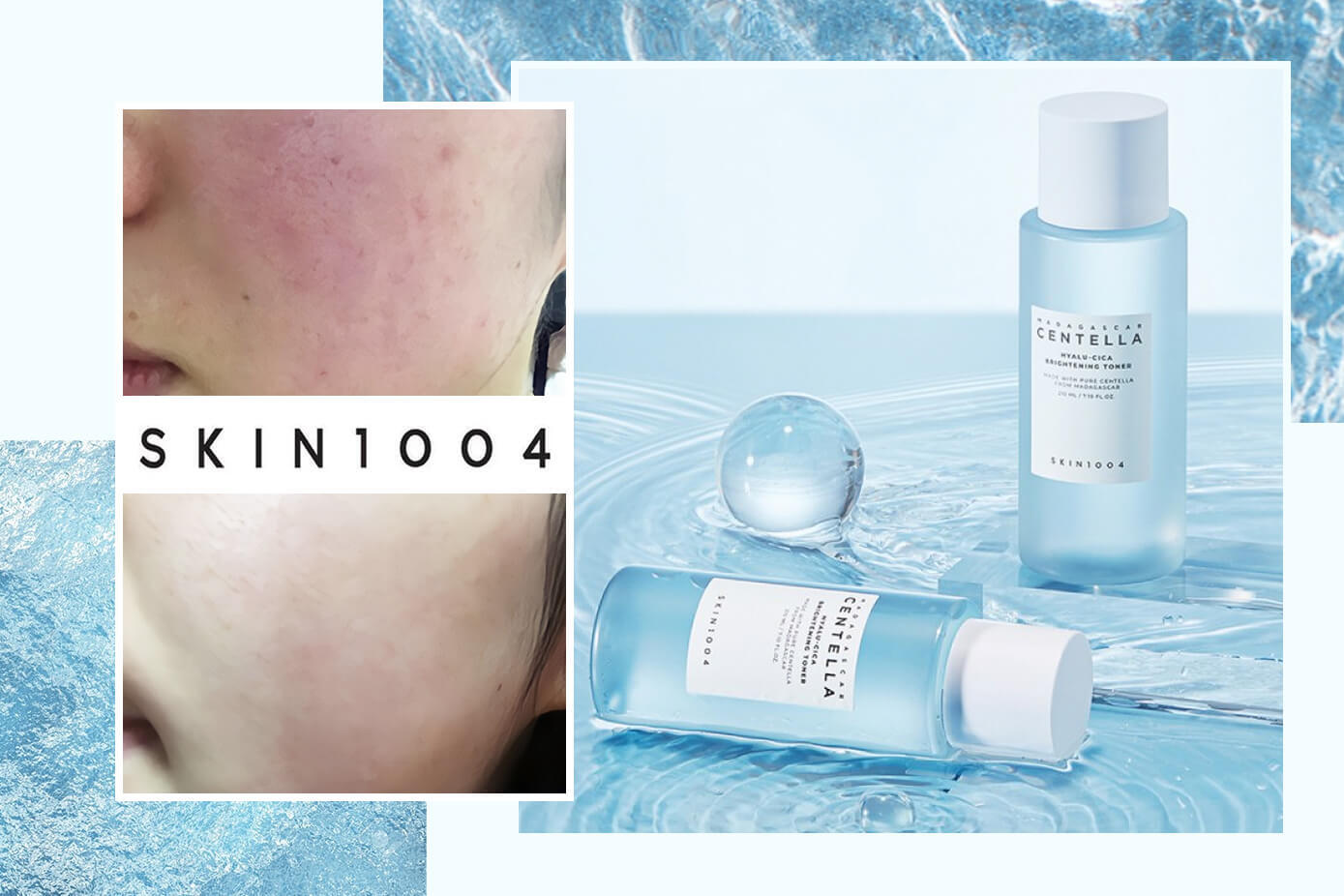 Review nước cân bằng Skin1004 - Chứa đến 74% rau má dành cho làn da siêu nhạy cảm