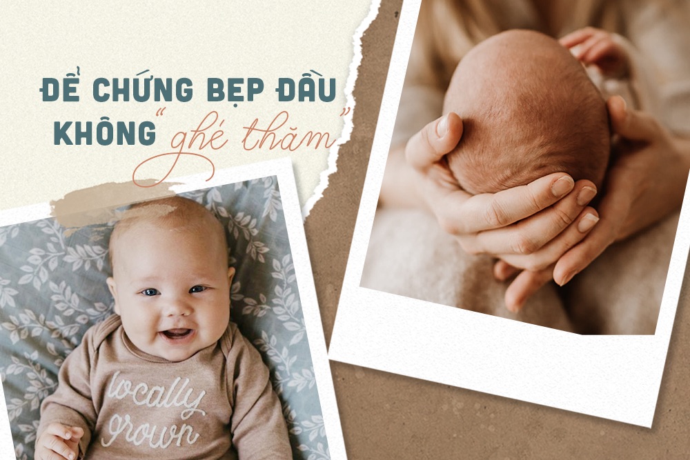 Thay đổi 3 chi tiết nhỏ trong lúc ngủ, mẹ an tâm xua tan nỗi lo bẹp đầu ở con yêu
