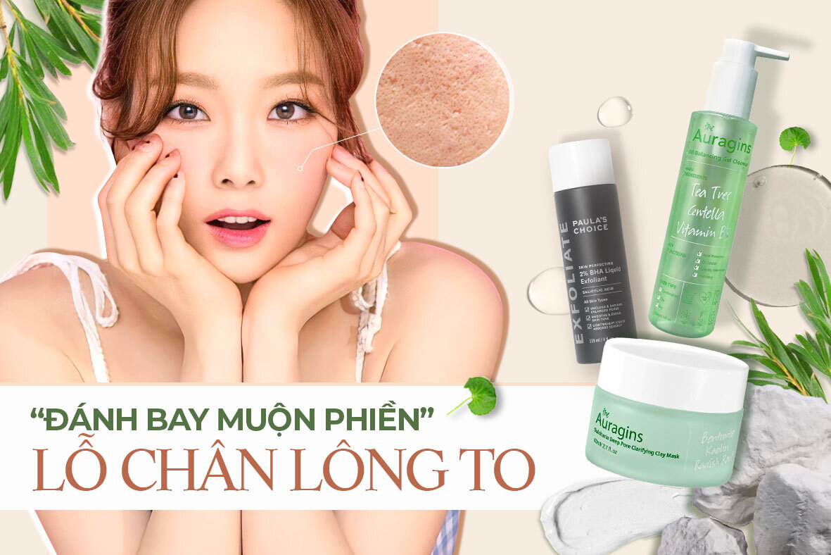 Ai đang đau đầu vì lỗ chân lông to, sắm ngay 3 "bửu bối" làm se da cực tốt này!