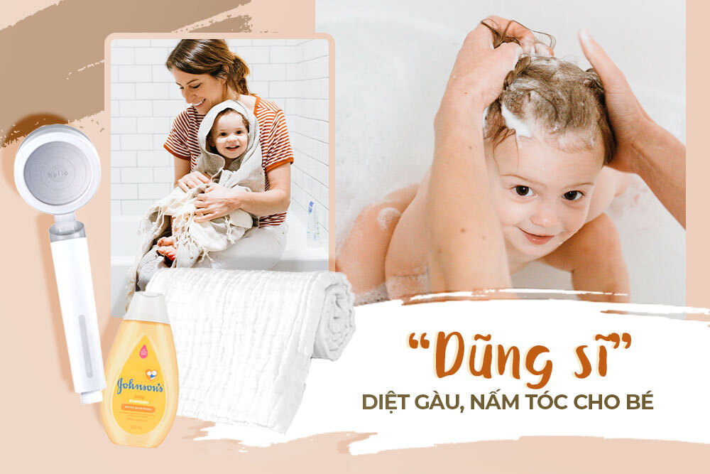 Muốn tóc bé hết gàu, nấm phải nhờ đến 3 sản phẩm này, nhất là “ứng viên” đầu tiên!