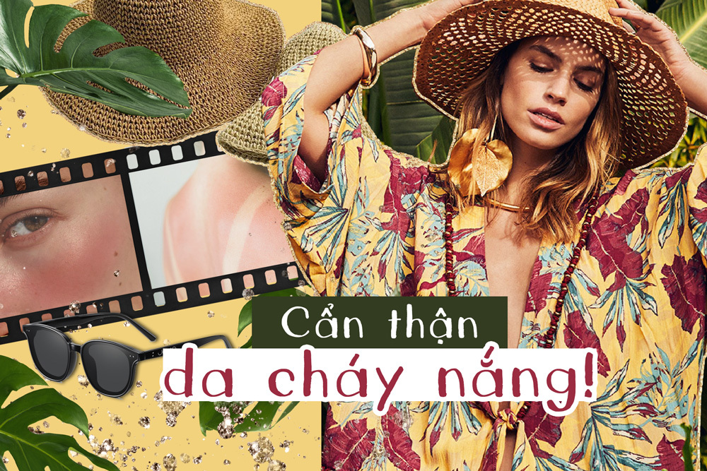 Da cháy nắng sau chuyến vi vu: Đừng dại làm 4 việc sau kẻo càng bỏng rát nàng ơi