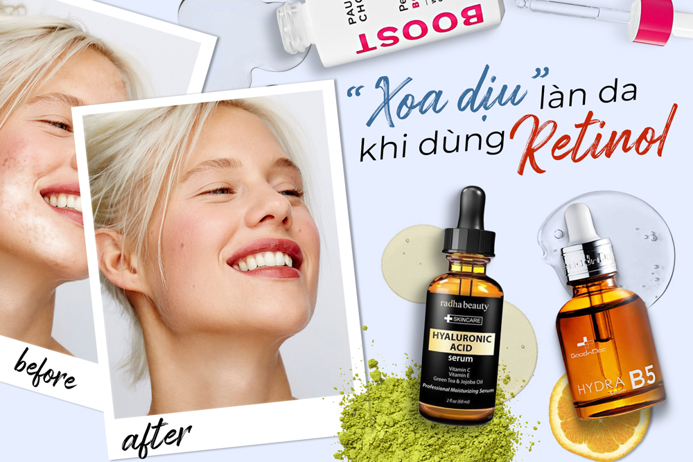 Dùng Retinol mà không có 5 chai serum phục hồi này, công cuộc chăm da coi như công cốc