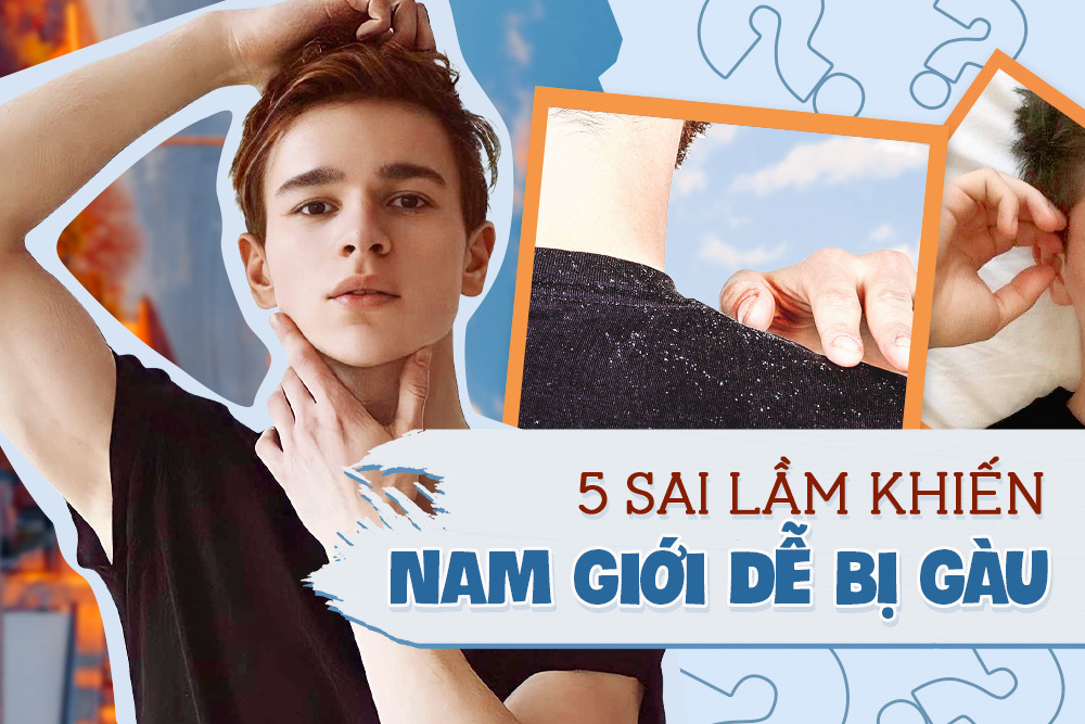 Gội đầu thường xuyên nhưng gàu vẫn không “buông tha”, các bạn nam xem ngay có mắc 5 sai lầm hair care sau