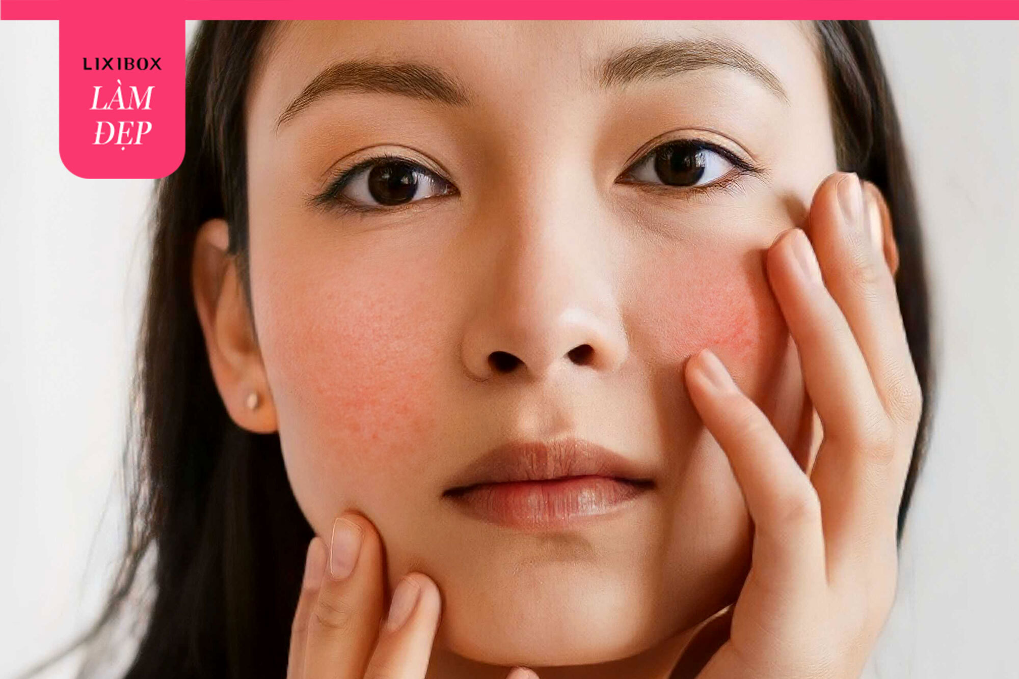 Peel da bị kích ứng: Nên làm gì?