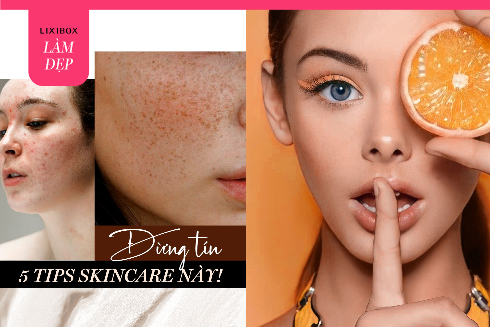 Cảnh báo: Nếu tiếp tục tin "sái cổ" 5 tips skincare này thì da bạn chắc chắn kích ứng, nổi mụn và sạm nám!