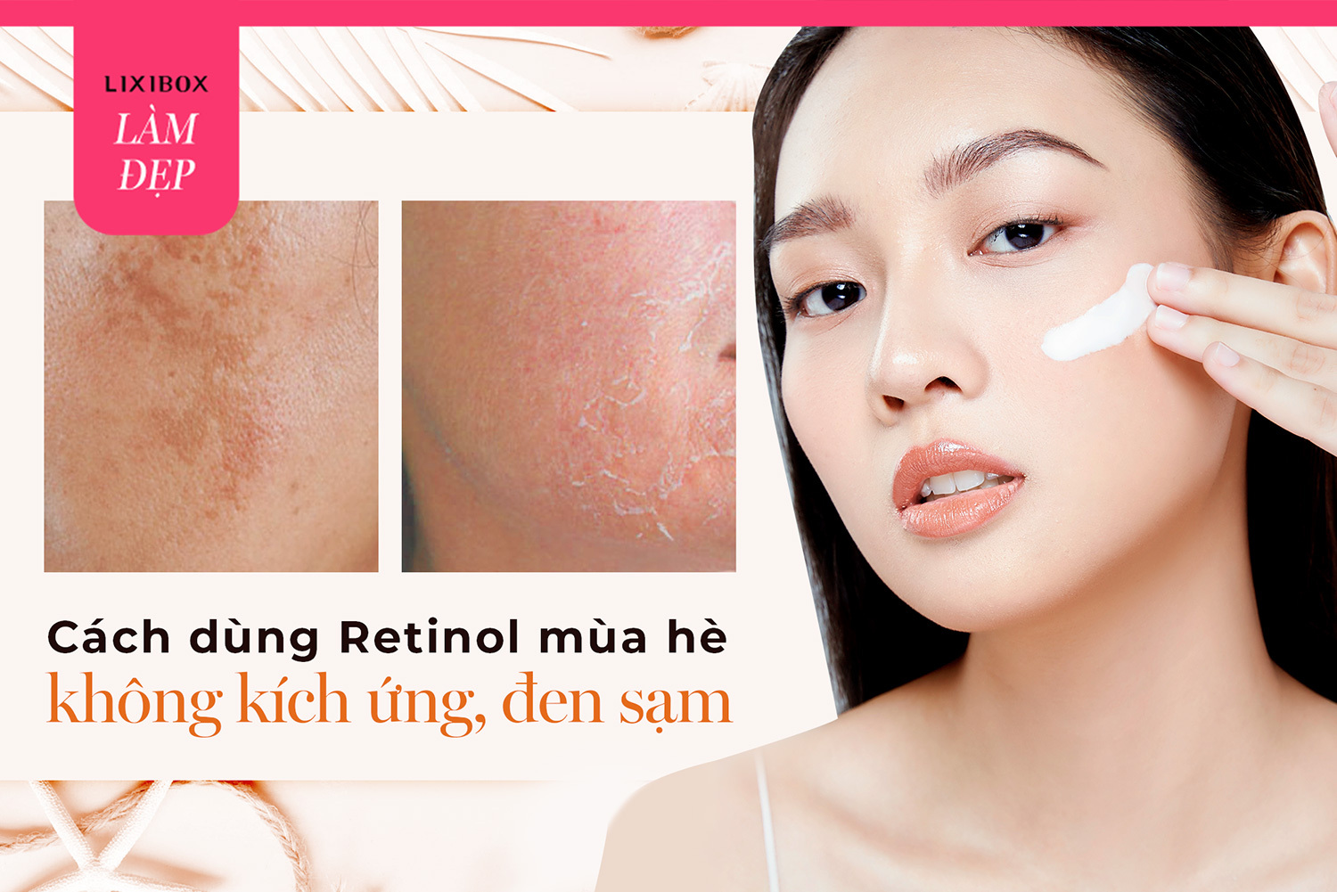 Có nên dùng Retinol vào mùa hè không? Đâu là cách dùng Retinol giúp da không đen sạm và kích ứng?