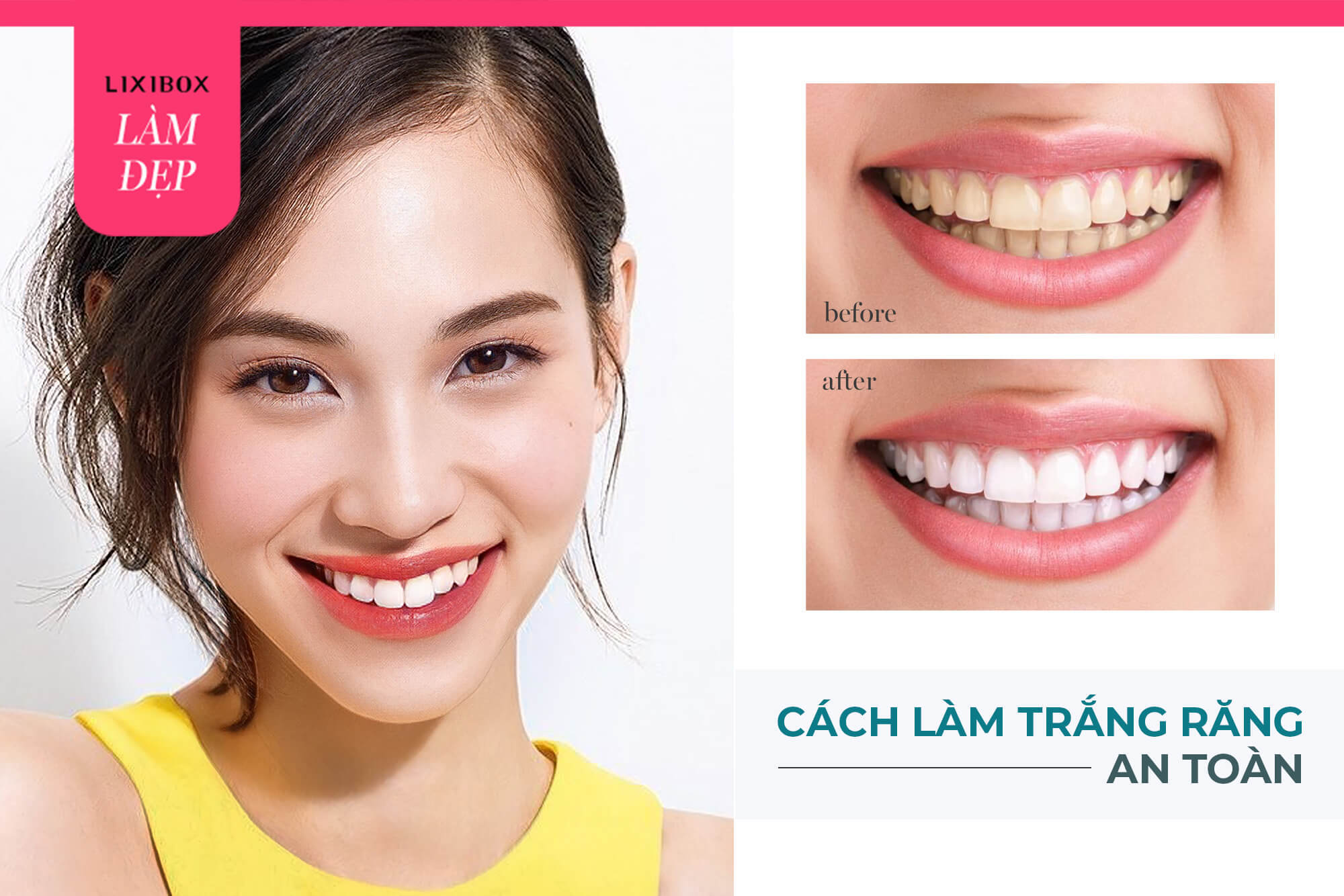 Dành cho team uống trà, cà phê: Đây là 6 cách làm trắng răng an toàn tại nhà cực dễ