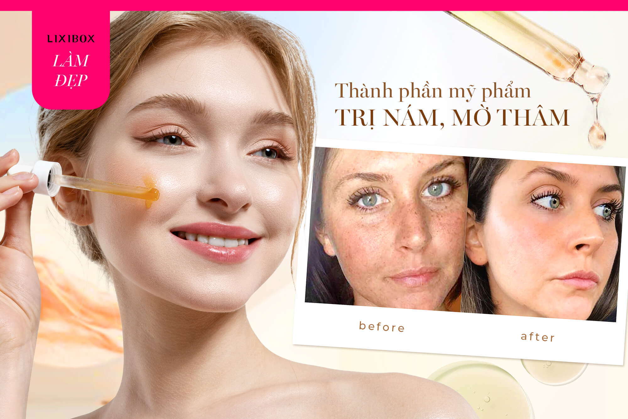 Muốn trị nám, mờ thâm nhanh chóng, bạn cần phải bôi thành phần mỹ phẩm này