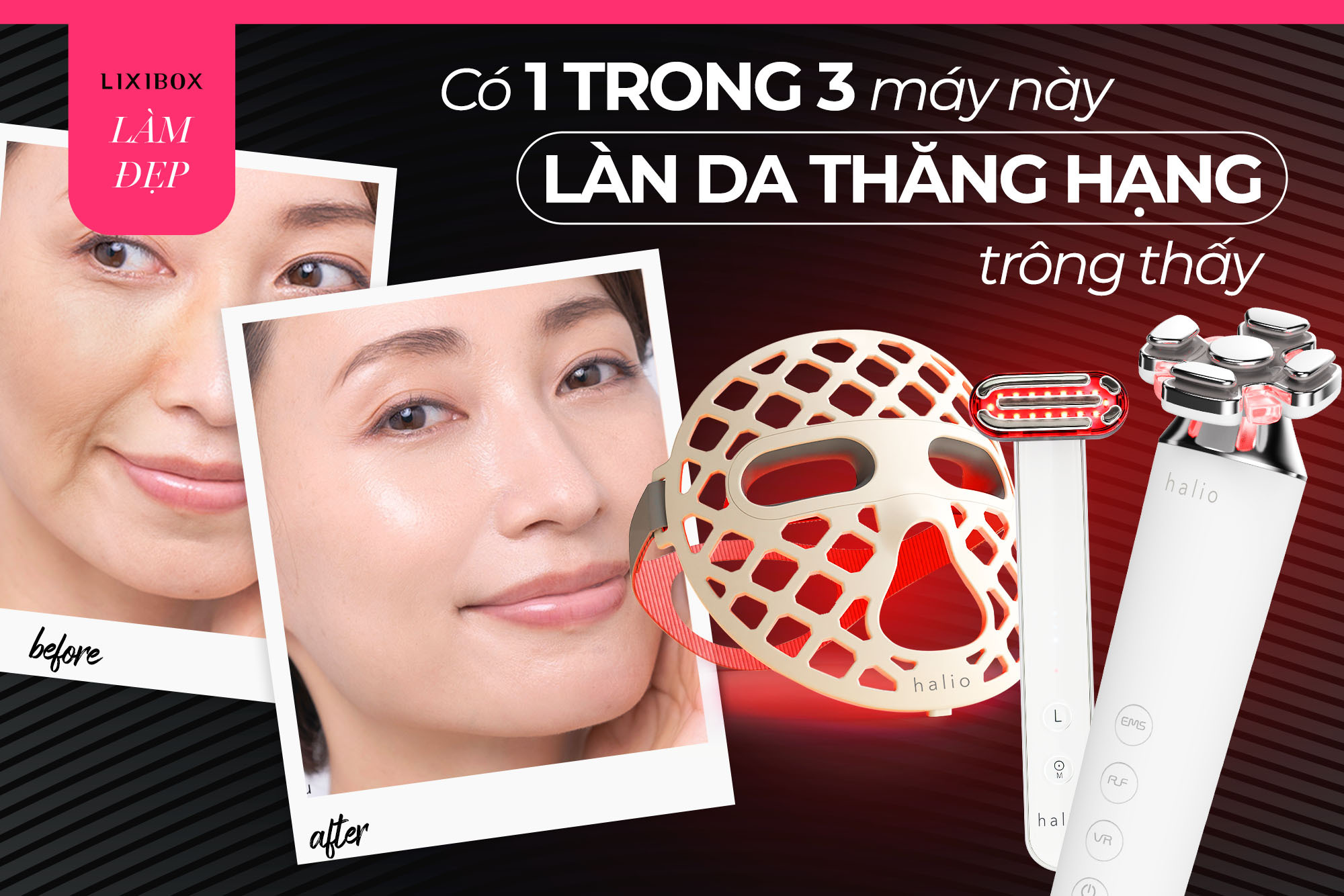 Halio mang công nghệ trẻ hóa cực hot trời Âu về Việt Nam: Có 1 trong 3 máy này làn da thăng hạng trông thấy