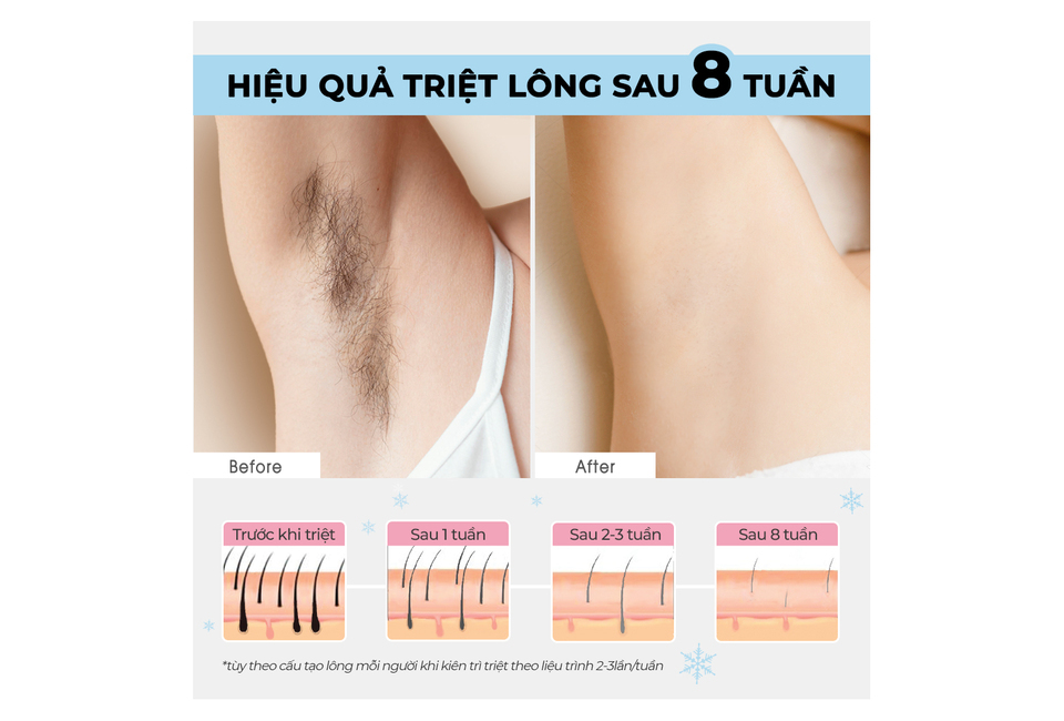 product image slider item
