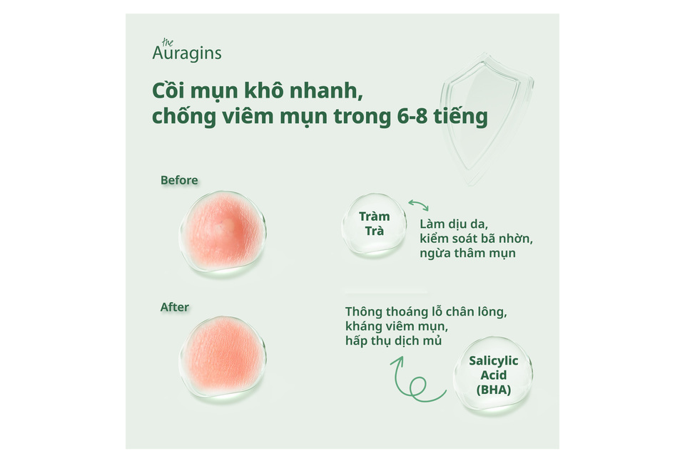Miếng Dán Mụn The Auragins Acne Rescue Patch Chứa BHA Làm Dịu Giảm Viêm Mụn 36 miếng giúp làm khô mụn nhanh, kiểm soát viêm mụn hiệu quả trong 6-8 tiếng. Sản phẩm chứa Salicylic Acid và chiết xuất tràm trà, là giải pháp lý tưởng cho làn da bị mụn.