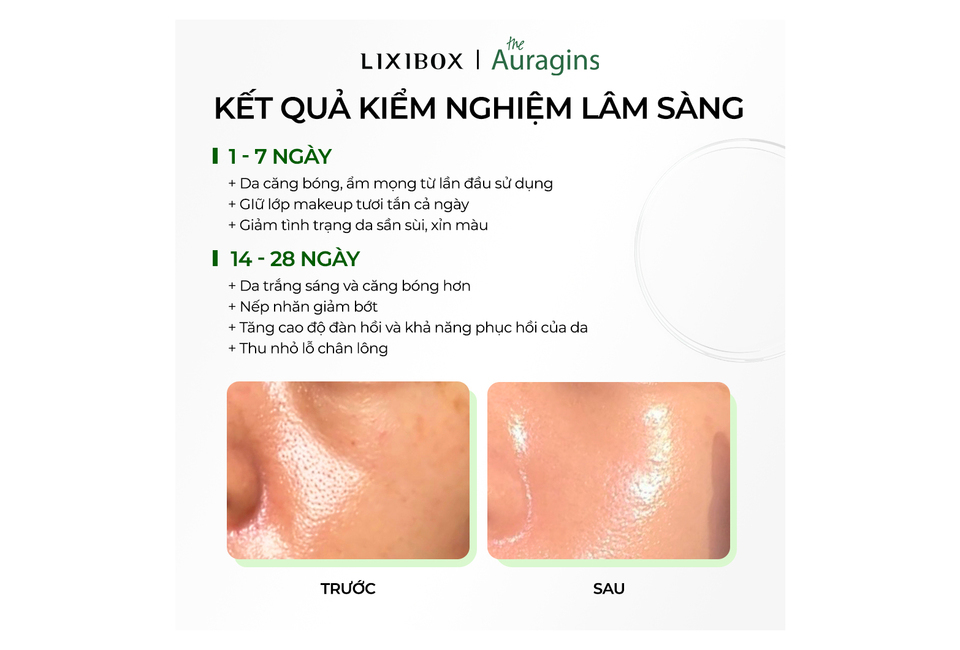 Kết quả kiêm nghiệm làm sáng da với Tinh Chất The Auragins Glow Complexion Serum 14% Vitamin C + 6 Berries Extracts. Hiệu quả trong 1-7 ngày và 14-28 ngày với da căng bóng, sáng hơn và giảm thâm nám, cải thiện tình trạng da.