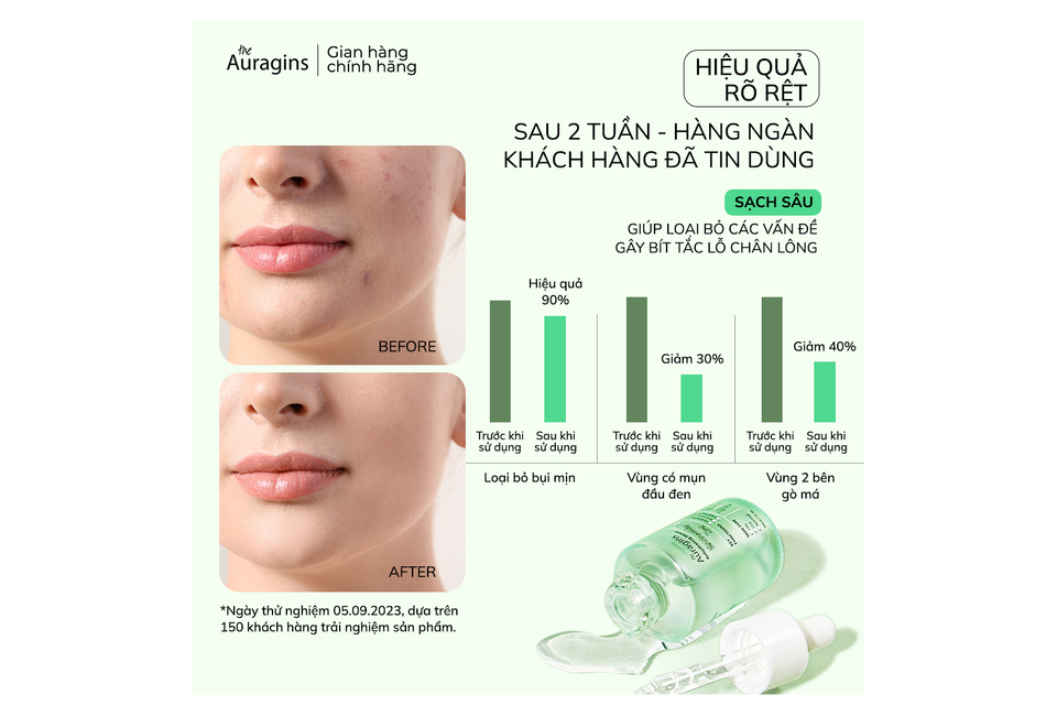 Combo 9 Bộ Ba Tinh Chất The Auragins Da Sạch Mịn Rạng Ngời Tự Tin Tặng Gel Rửa Mặt Cho Da Dầu Mụn + Đá Guasha cho kết quả rõ rệt sau 2 tuần, giúp cải thiện 90% tình trạng da, giảm mụn và tình trạng bít tắc lỗ chân lông.