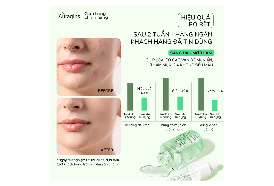 Combo 10 Bộ Đôi Tinh Chất Kiểm Soát Dầu Mụn The Auragins, bao gồm các sản phẩm giúp sáng da và giảm mụn sau 2 tuần sử dụng, kèm Gel Rửa Mặt cho da dầu mụn và Dụng Cụ Massage Mặt Gua Sha.