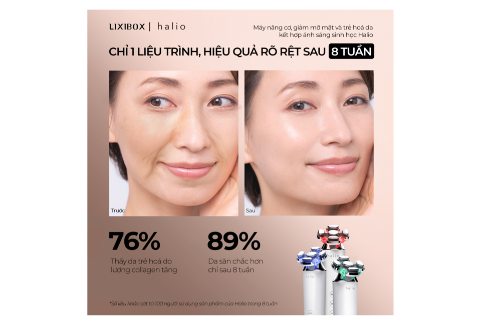 Máy Nâng Cơ, Giảm Mỡ Mặt & Trẻ Hoá Da Halio RevitaWave thể hiện hiệu quả rõ rệt sau 8 tuần, với 76% người dùng thấy da trẻ hóa và 89% cảm nhận da săn chắc hơn. Trước và sau liệu trình chỉ sau 1 lần sử dụng.