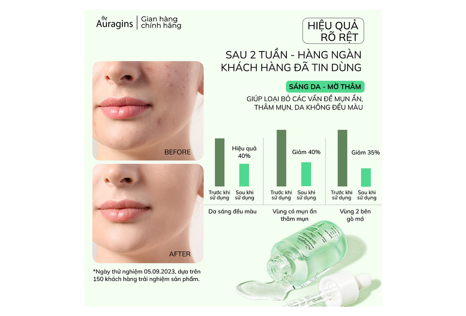 Box Combo 2 Hỗ Trợ Sáng Da Giảm Mụn Ẩn Mờ Thâm Dưỡng Ẩm Serum The Auragins 10% Niacinamide + 1% Zinc + Máy Rửa Mặt Halio Facial Cleansing, chưa sử dụng và sử dụng 2 tuần cho hiệu quả sáng da và chăm sóc mụn.