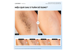 Máy Triệt Lông Halio SilkGlow IPL Sapphire Cooling Hair Removal Device cho thấy hiệu quả sau 3 tuần sử dụng, với hình ảnh trước và sau điều trị, cùng hướng dẫn quy trình triệt lông đúng cách.