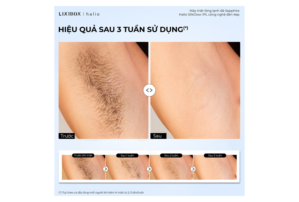 Kết quả hiệu quả của Máy Triệt Lông Halio SilkGlow IPL Sapphire Cooling Hair Removal Device sau 3 tuần sử dụng, so sánh hình ảnh trước và sau khi sử dụng, thể hiện sự thay đổi rõ rệt.