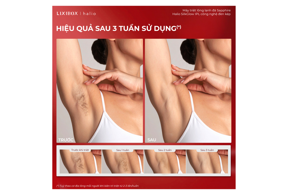 Máy Triệt Lông Halio SilkGlow IPL Sapphire Cooling Hair Removal Device - Rouge cho thấy hiệu quả sau 3 tuần sử dụng, với hình ảnh 'trước' và 'sau'. Các giai đoạn từ trước khi triệt đến sau 1, 2 và 3 tuần đều được thể hiện rõ ràng.